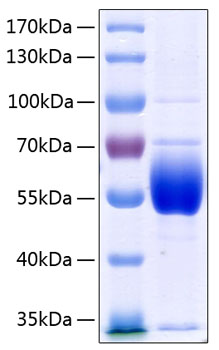 Recombinant Human Serpin C1/Antithrombin-III Protein