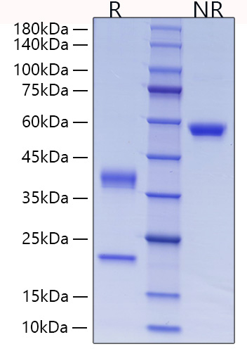 Recombinant Human Complement C1r subcomponent Protein