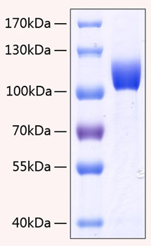 Recombinant Human FGFR-3 alpha (IIIc)/CD333 Protein