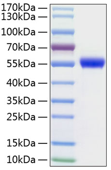 Recombinant Human uPA/PLAU Protein