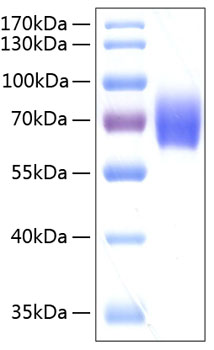 Recombinant Human Serpin F2/Alpha-2-antiplasmin Protein