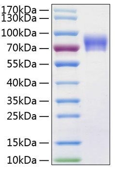 Recombinant Human Vanin-1/VNN1 Protein