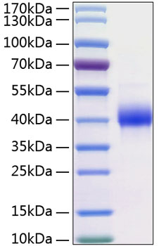 Recombinant Human Kallikrein-11/KLK11 Protein