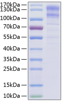 Recombinant Human Low-density lipoprotein receptor/LDLR Protein