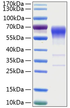 Recombinant Human Activin RIIB/ACVR2B Protein