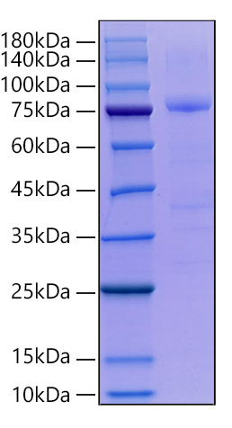 Recombinant Human AGER/RAGE Protein