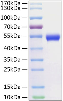 Recombinant Human CD5 Protein