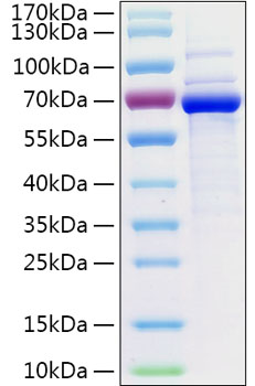 Recombinant Human5'-Nucleotidase/NT5E/CD73 Protein