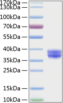 Recombinant Human Cell surface A33 antigen/GPA33 Protein