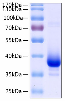 Recombinant Human TNFRSF12A/TWEAKR/CD266 Protein