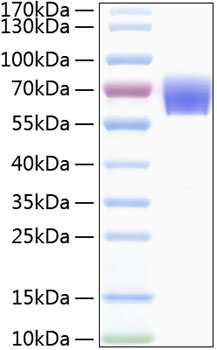 Recombinant Human TREM-1/CD354 Protein