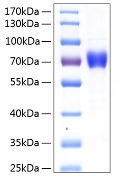 Recombinant Human IL-12A/IL-12 p35 Protein