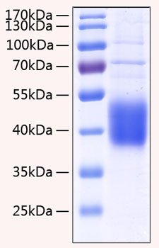 Recombinant Human IL-21R/CD360 Protein