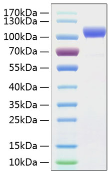 Recombinant Human ErbB-2/HER2/CD340 Protein