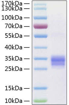 Recombinant Human TNFSF11/RANKL/CD254 Protein