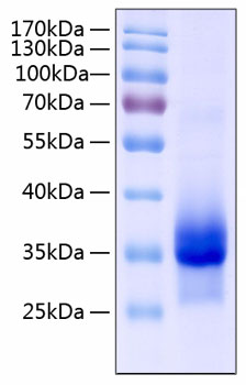 Recombinant Human IGFBP-4 Protein