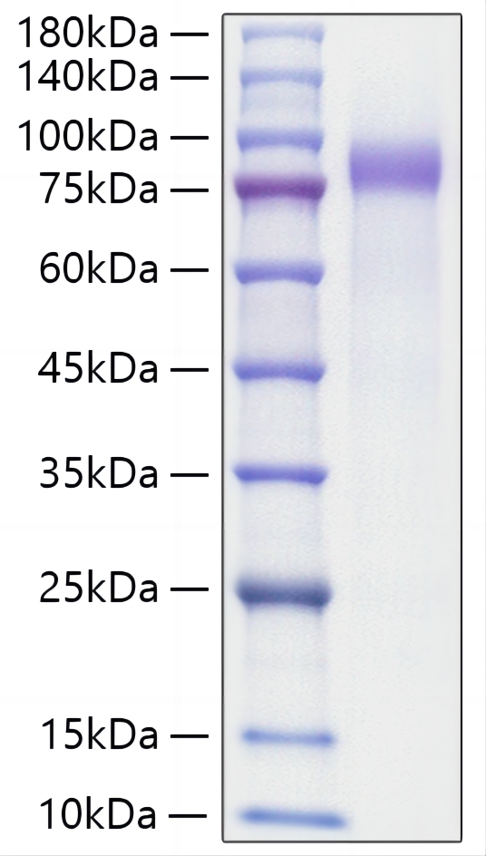 Recombinant Human Progranulin/PGRN/GRN Protein