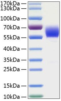 Recombinant Human Serpin A3/Alpha-1-antichymotrypsin Protein