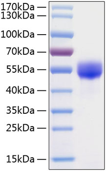 Recombinant Human Fetuin A/AHSG Protein