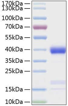 Recombinant Human Azurocidin/CAP37/AZU1 Protein