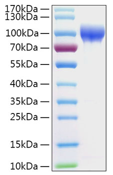 Recombinant Human Serpin G1/Plasma protease C1 inhibitor Protein