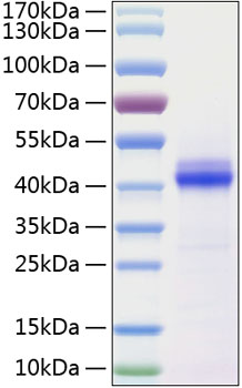 Recombinant Human CD5L Protein