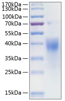 Recombinant Human IFN-gamma R1/CD119 Protein