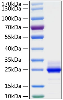 Recombinant Human IL-6 Protein