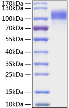 Recombinant Human HER1/ERBB1/EGFR Protein