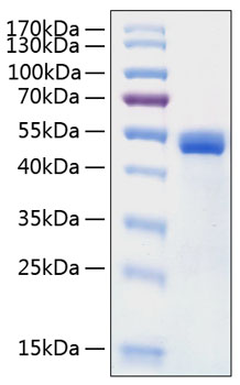 Recombinant Human Cathepsin D Protein