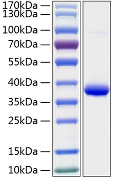 Recombinant Human IGFBP-2 Protein