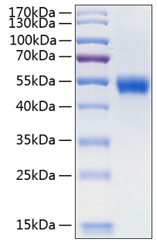 Recombinant Human Lumican/LUM Protein