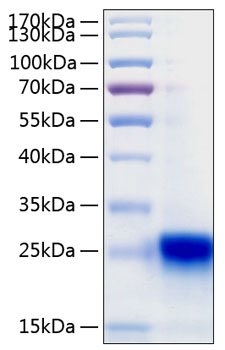 Recombinant Human IFN-lambda 3/IL-28B Protein