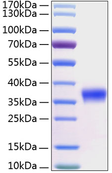 Recombinant Human Kallikrein-8/KLK8 Protein