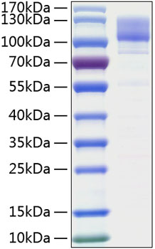 Recombinant Human ITGB1/CD29 Protein