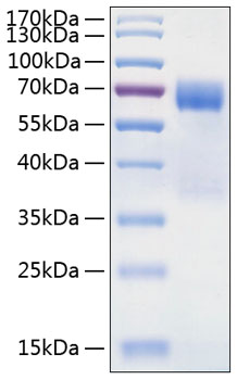 Recombinant Human TIM-3/HAVCR2/CD366 Protein