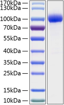 Recombinant Human IL-1R2/CD121b Protein