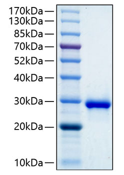 Recombinant Human IGFBP-1 Protein