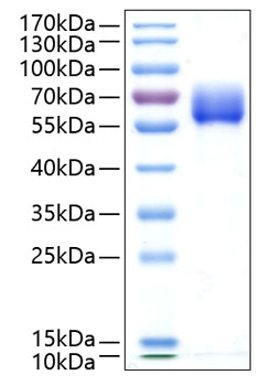 Recombinant Human TGF-beta receptor type-2/TGFR-2 Protein