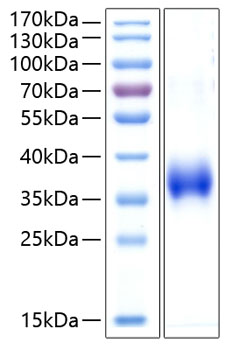 Recombinant Human CD2 Protein