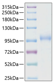 Recombinant Human CDH6/K-Cadherin Protein