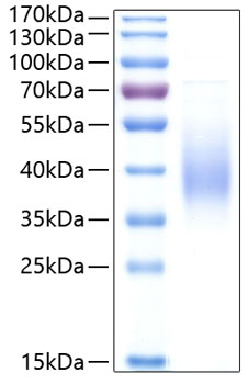 Recombinant Human Fc-epsilon RI-alpha/FCER1A Protein