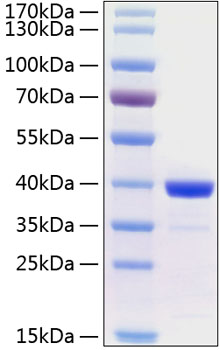 Recombinant Human Arginase 1/ARG1 Protein