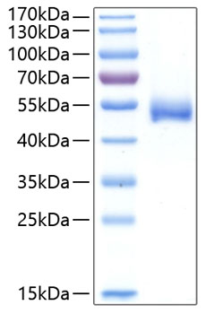 Recombinant Human Chitinase-1/CHIT1 Protein