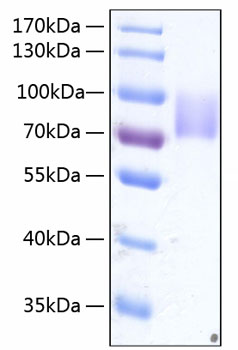 Recombinant Human Growth hormone receptor/GHR Protein