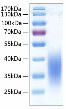 Recombinant Human B7-H5/Gi24/VISTA Protein