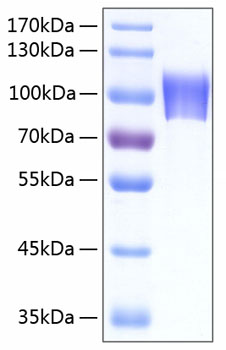 Recombinant Human Neuroligin-4/NLGN4X Protein