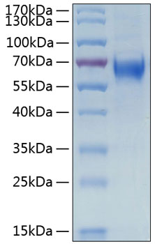 Recombinant Human IL-6RA/CD126 Protein