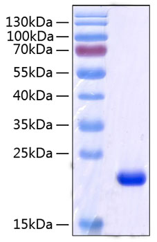 Recombinant Human Retinol-binding protein 4/PRBP Protein