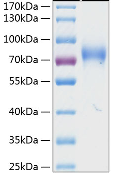 Recombinant Human NKAT-2/KIR2DL3/CD158b2 Protein